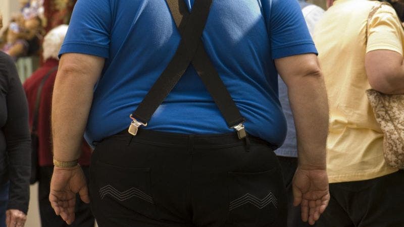 La obesidad es una enfermedad que requiere tratamiento multidisciplinario a largo a plazo