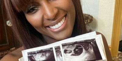 Amara la Negra confiesa está embarazada y para sorpresa de gemelos