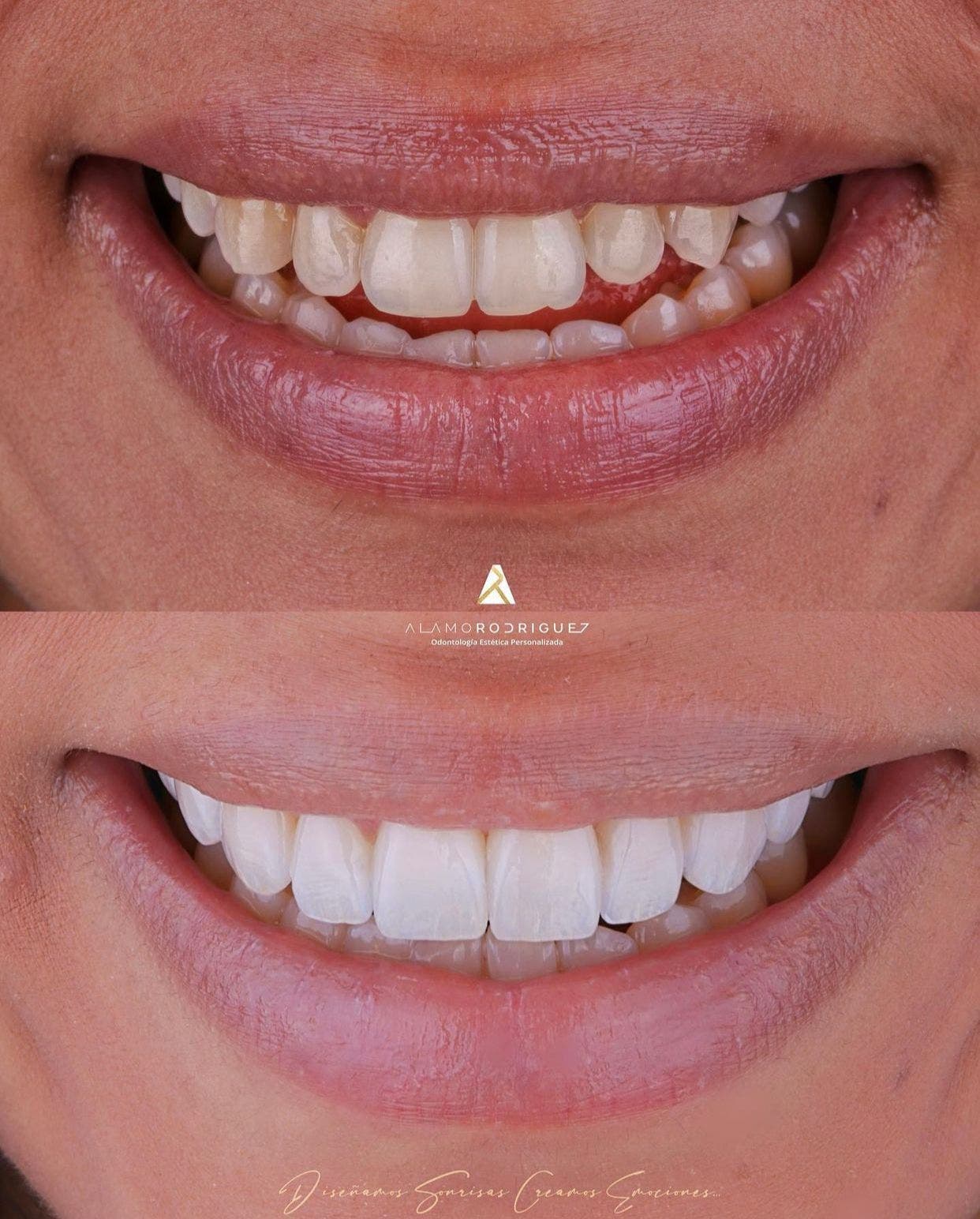 Odontólogo presenta nueva técnica de diseño de sonrisas