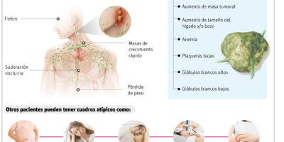 Linfoma, un cáncer que no discrimina la edad, raza ni nivel socioeconómico