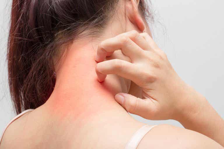 Dermatóloga llama estar alerta ante lesiones y alteraciones en la piel