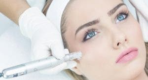 El microneedling y sus beneficios  cosméticos y terapéuticos en la piel