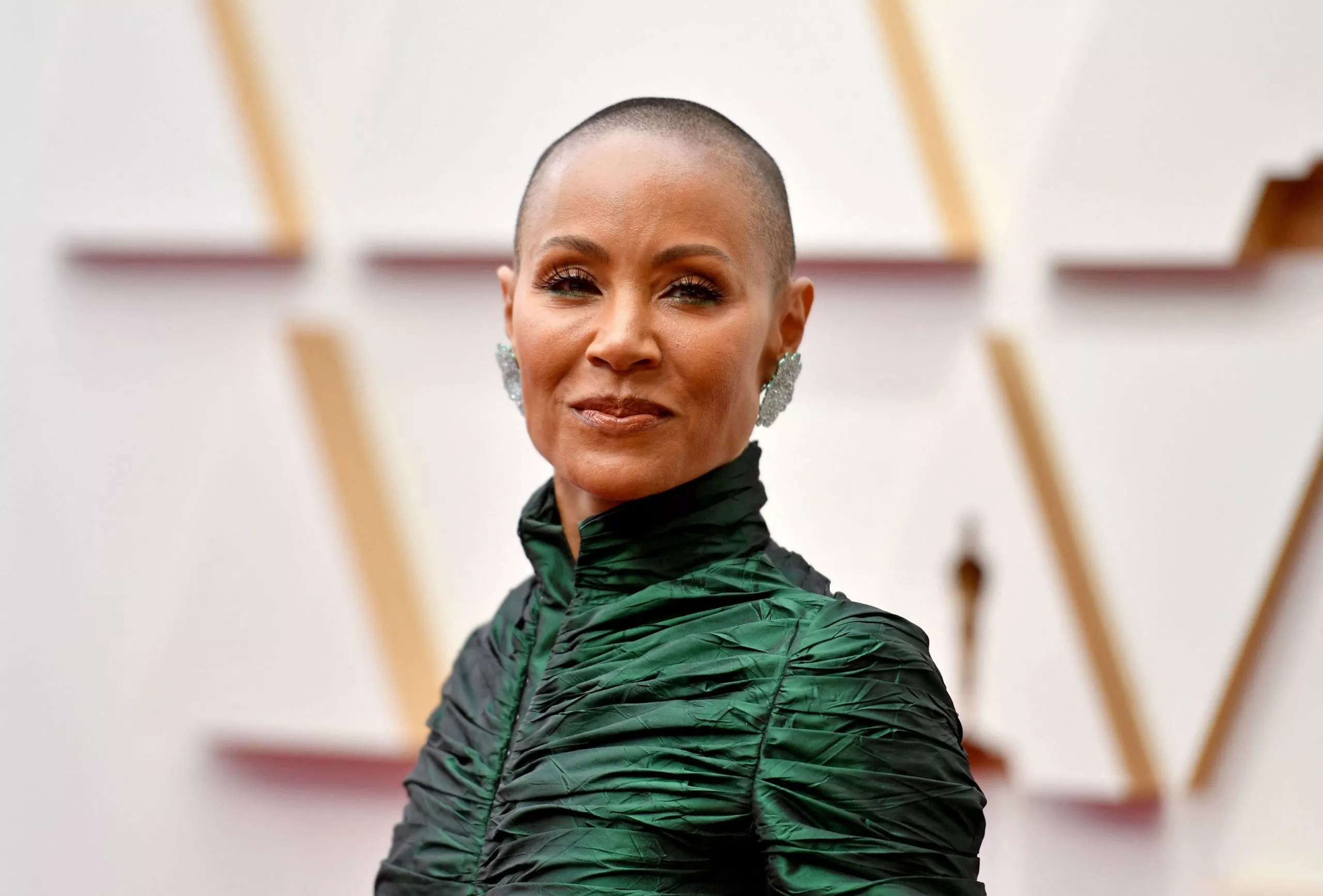 La alopecia de Jada Pinkett podría ser un trastorno genético y autoinmune