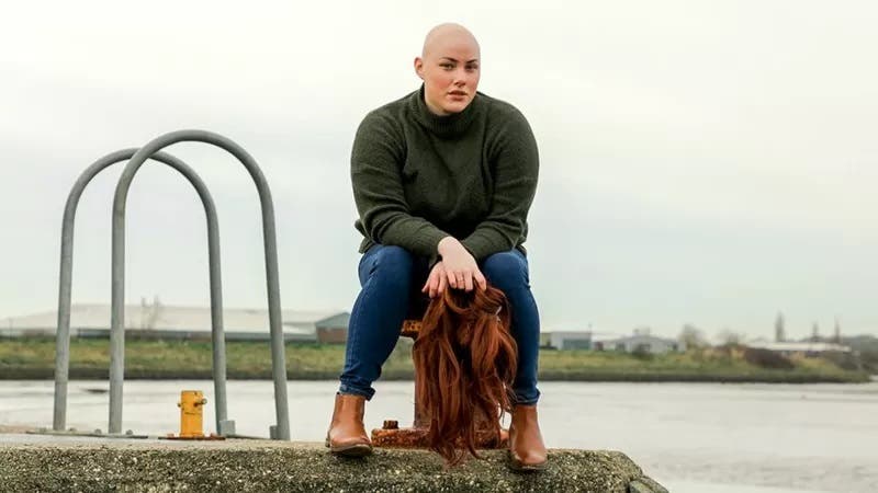 Alopecia: «Ahora puedo salir sin peluca y la gente no asumirá que tengo cáncer»