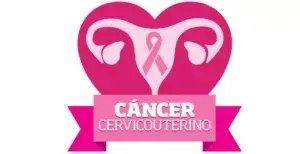 Salud llama a mujer prevenir cáncer cérvico uterino