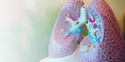 Cáncer de pulmón, una enfermedad que provoca pocos síntomas