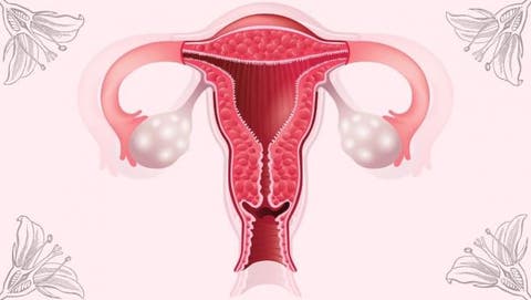 Cáncer de Ovarios: a partir de los 50 años el riesgo de padecerlo aumenta