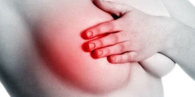 El 20 por ciento cáncer de mama impacta mujeres en edad de parir