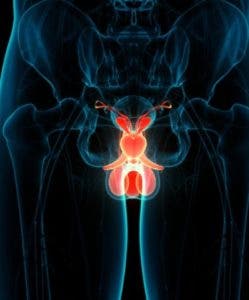 Cáncer  próstata, el más diagnosticado