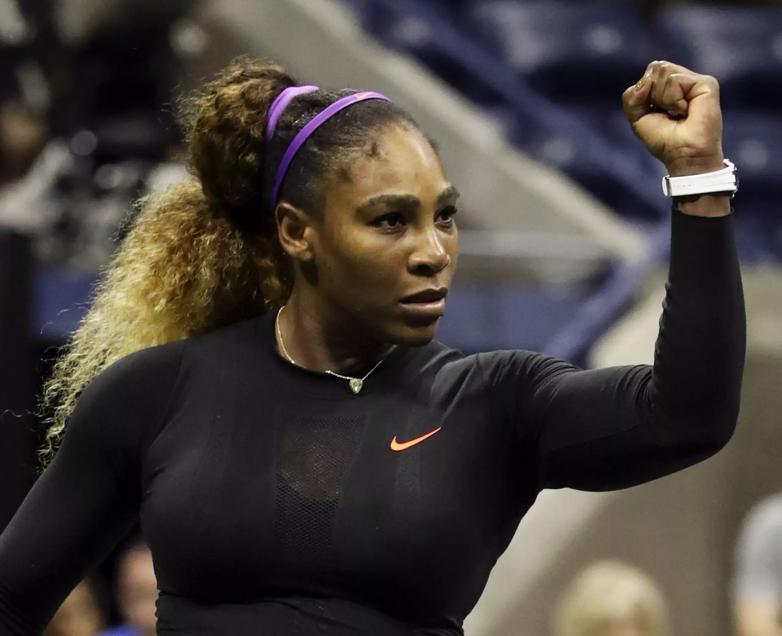 Serena Williams, operada con éxito para quitar un quiste en su cuello