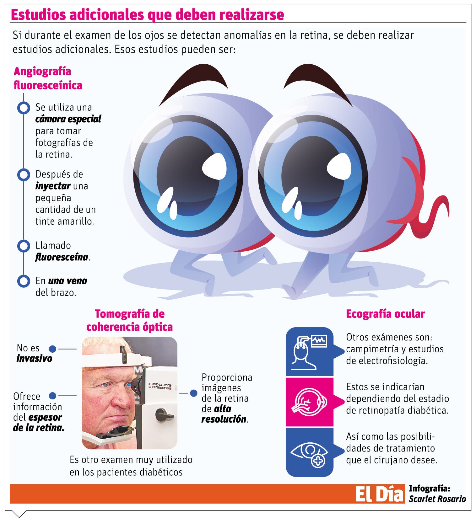 Diabetes ocular y sus efectos sobre la visión