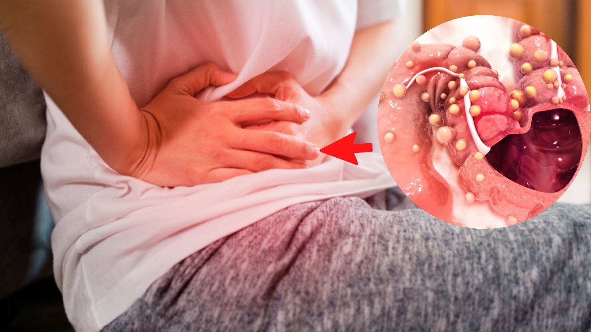 Oncólogo: “El tumor de colon está ligado a la vejez”
