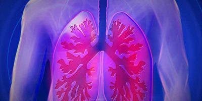 Pacientes fibrosis quística dependen de oxígeno oficial y particular