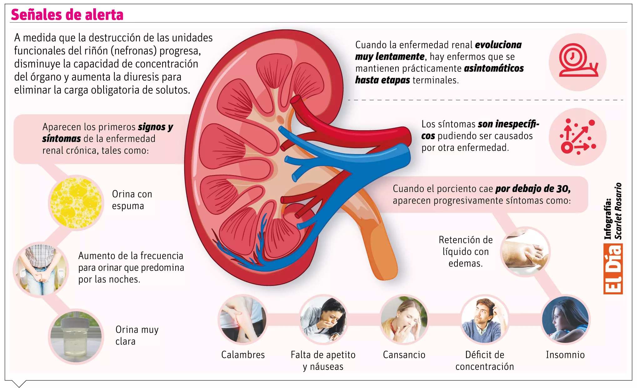 Nefropatía hipertensiva, un factor importante de la progresión de la ERC