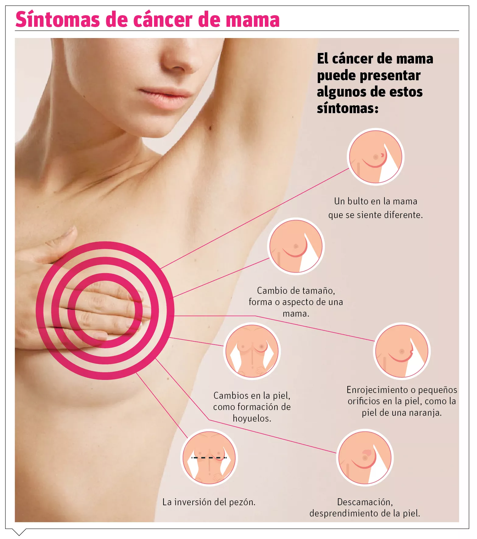 Estudios diagnósticos de cáncer de mama, ¿Cuáles son y cómo acceder a ellos?