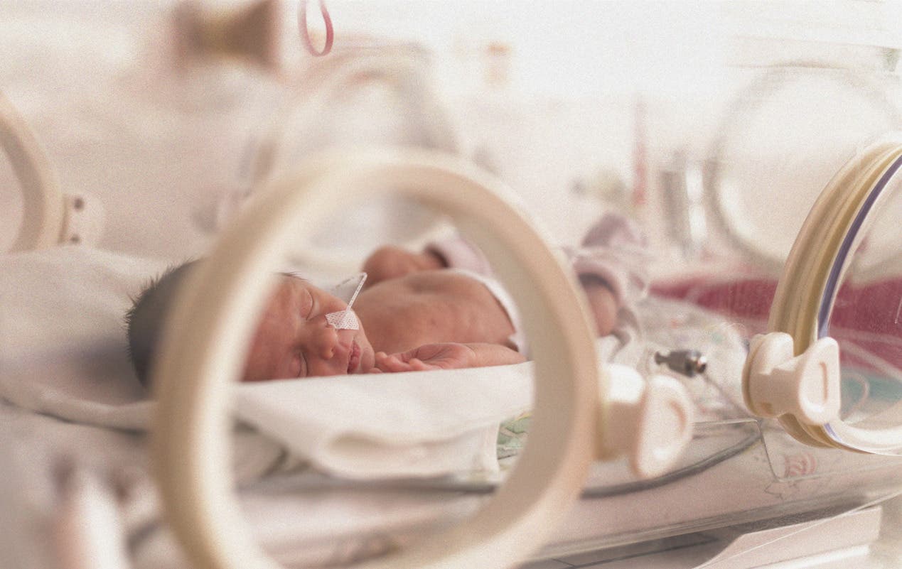 El 8.2 % de los nacimientos son prematuros en RD