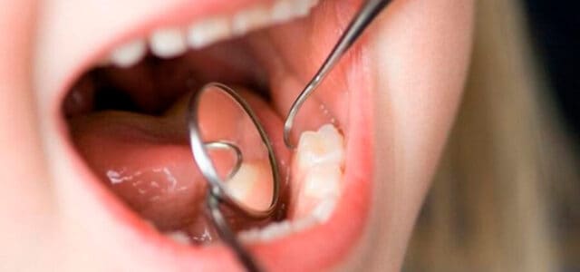 OMS: El 45 % de la población global sufre enfermedades dentales