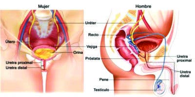 Causa más frecuente de uretritis es infecciosa