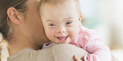 La drástica caída de nacimientos de bebés con síndrome de Down en Europa