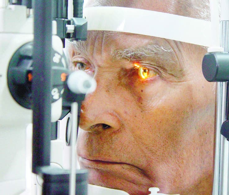 El glaucoma le sigue robando la visión a muchos dominicanos