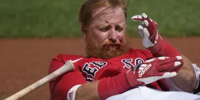 Justin Turner sale de juego tras ser golpeado en la cabeza