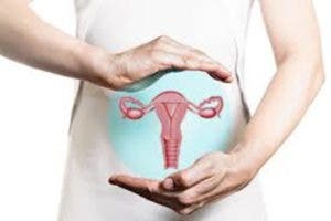 Sociedad Oncología recomienda reorientar campañas en cáncer cuello uterino