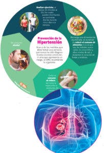 La hipertensión pulmonar es una enfermedad multifactorial