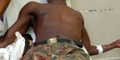 Cabo del Ejército resulta herido y despojado de fusil en Elías Piña