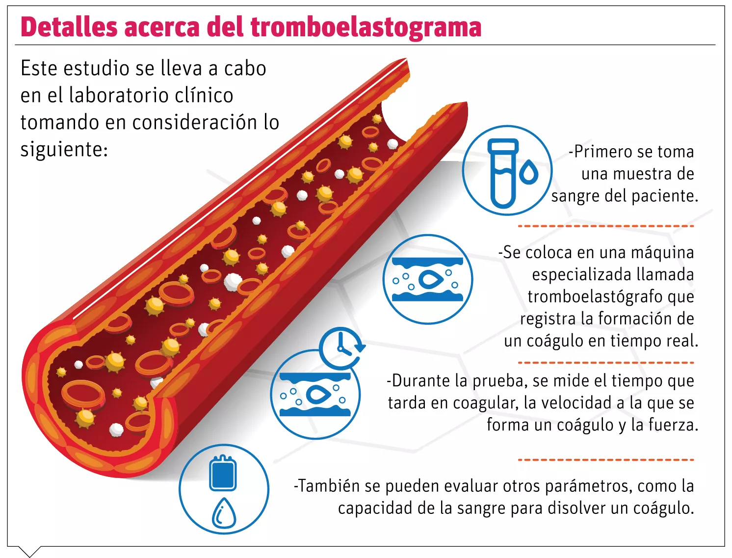 Tromboelastograma:   útil en la evaluación de la coagulación sanguínea