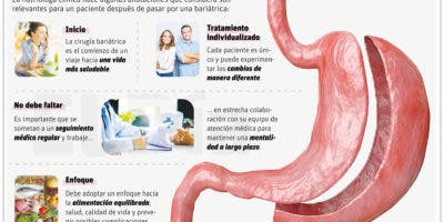 El 10% de pacientes con cirugía bariátrica vuelven a ganar peso