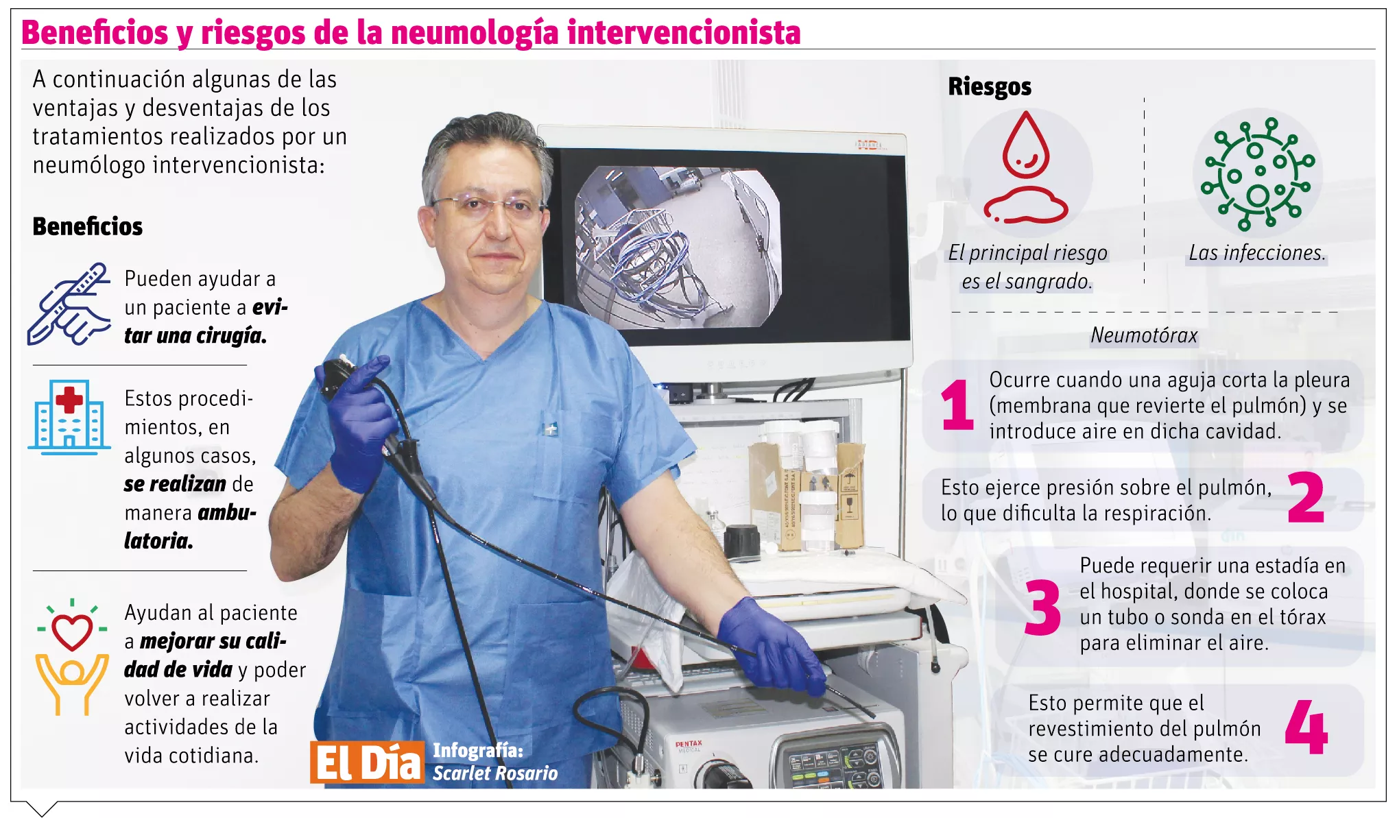 La neumología intervencionista diversifica tipos de tratamientos