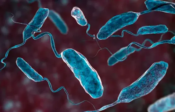 La ingesta de agua o alimentos contaminados con la bacteria Vibrio cholerae. Fuente externa