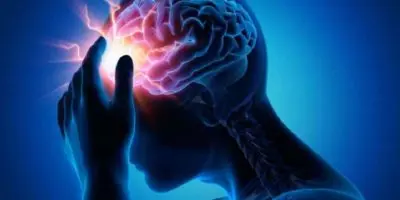 Estudio muestra beneficios de la estimulación cerebral profunda para pacientes con accidente cerebrovascular