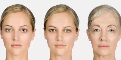 Las curiosas formas en que tu piel revela tu salud (y qué puedes hacer para cuidarla)