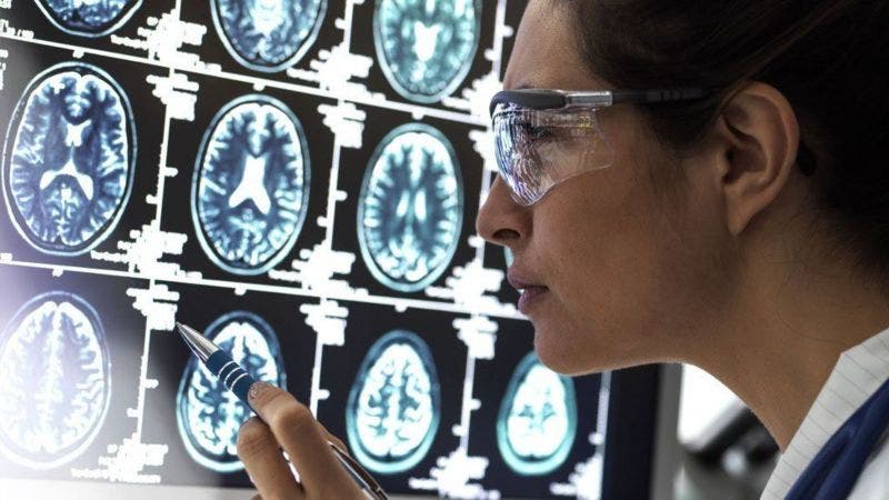 Dos buenas noticias sobre el tratamiento del Alzheimer y una mala de otras formas de demencia