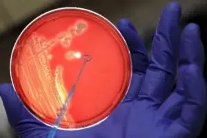 ¿Existe la ‘bacteria carnívora’?