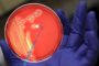 ¿Existe la ‘bacteria carnívora’?