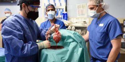 Realizan el segundo trasplante de un corazón de cerdo a un humano para intentar salvarlo