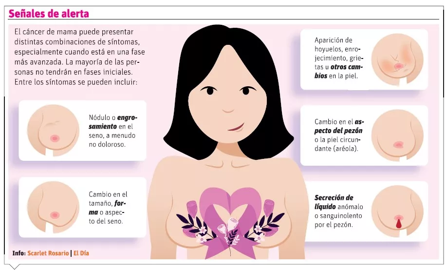 Avances en tratamiento de cáncer de mama; cada día con más esperanza