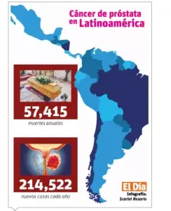 El 80 % de los pacientes con cáncer de próstata son asintomáticos