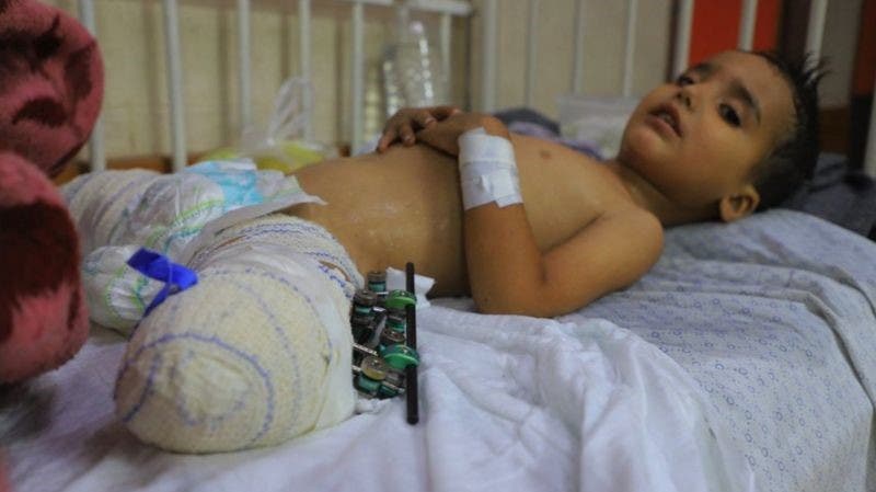 “Niño herido, familia no sobrevivió”: la desoladora descripción de cientos de niños que quedaron huérfanos en Gaza