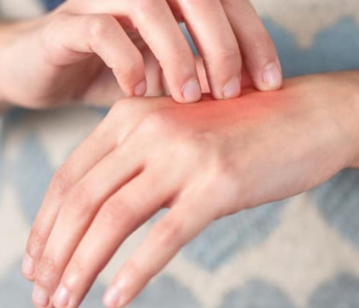 Lesiones en manos y pies son de alto riesgo, sugieren poner atención