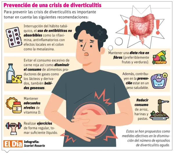 info-DIVERTICULITI