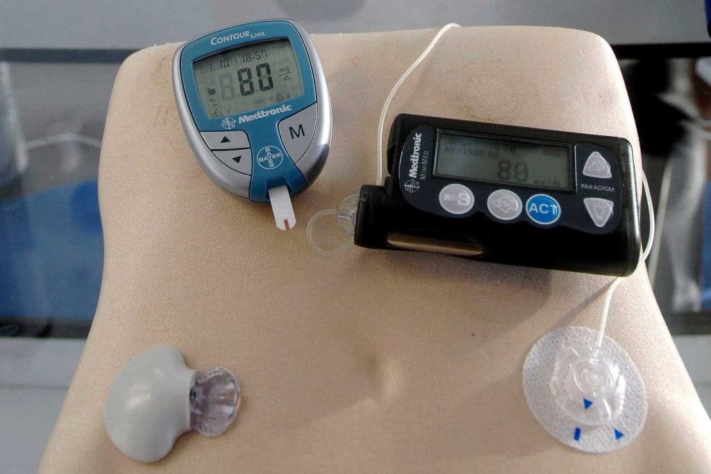 Expertos instan a dejar atrás el termino prediabetes por diabetes tipo 2