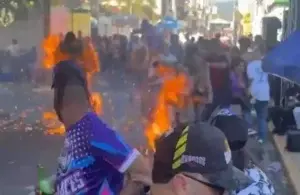 Quemados en el carnaval Salcedo están sin mejoría