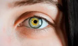 Glaucoma: Prevención, diagnóstico y avances