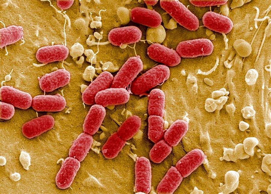 Qué es la resistencias antimicrobianas