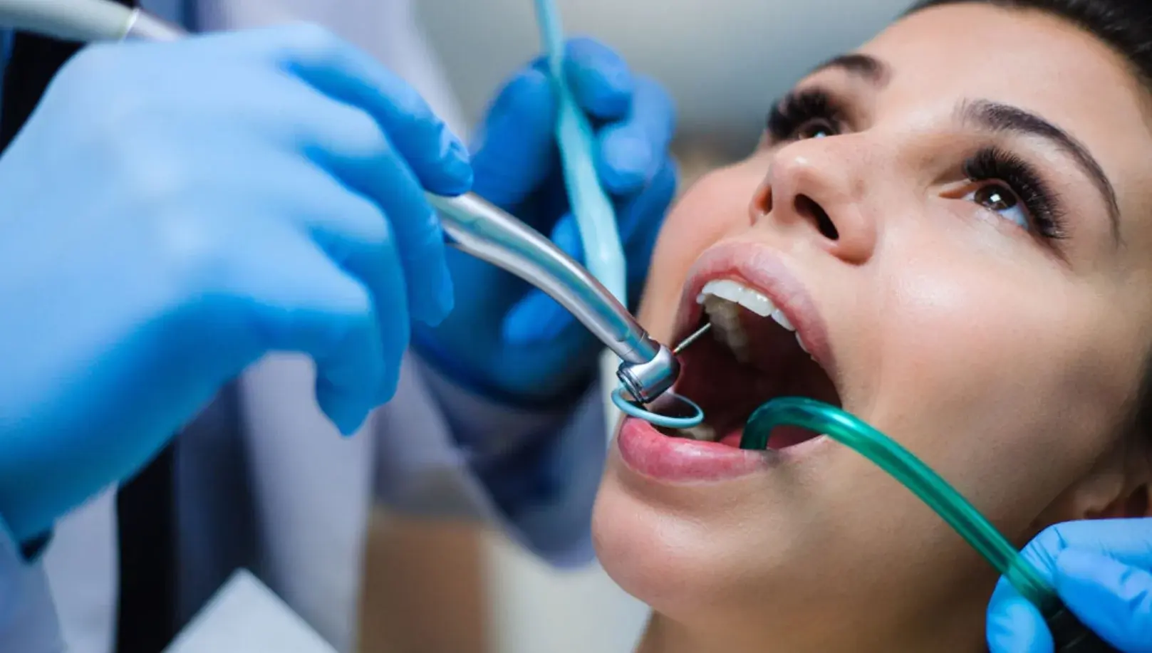 La endodoncia:  apuesta segura para preservar el diente en la boca