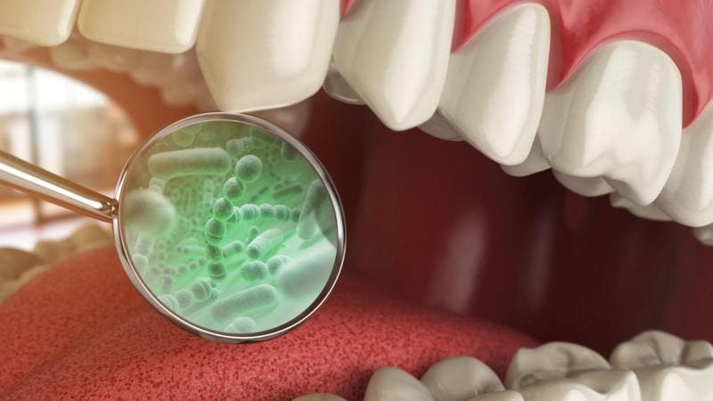 4 enfermedades vinculadas a las bacterias de tu boca
