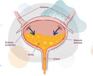 Guía para pacientes de cáncer de vejiga